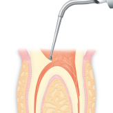 Endodontics/E15D -varios2