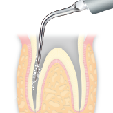 Endodontics/E4 -varios