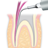 Endodontics/E5 -varios