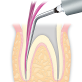 Endodontics/E6 -varios