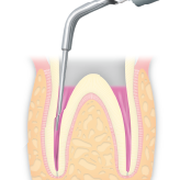 Endodontics/E7 -varios